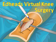 Edheads Virtual Knee Surgery