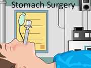 Stomach Surgery